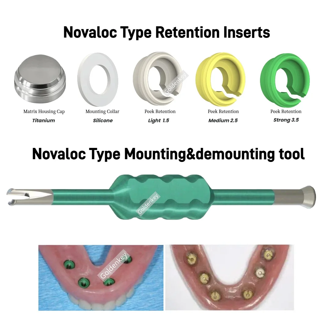 

Набор для обработки зубных протезов Dental Novaloc: вставки PEEK, силиконовые колпачки, титановые фиксаторы, инструмент для крепления абатментов