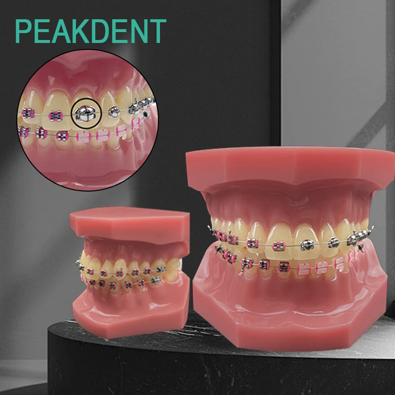 

Стоматологическая ортодонтическая модель с металлическим самоблокирующимся ортодонтическим лечением, стоматологическая модель, обучающие упражнения для стоматологии