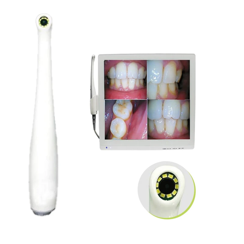 All-in-One Dental Endoscope Class 18 Million Ultra-HD Multifunctional Computer Oral Observation Device