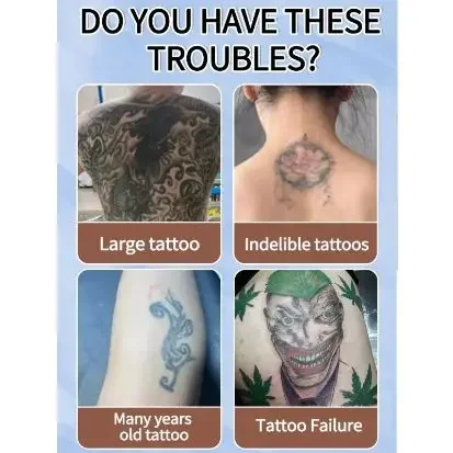 

Гель для удаления татуировок, растворяющий восход татуировок, увлажняющий кожу, безболезненный, глубоко очищающий гель для ухода