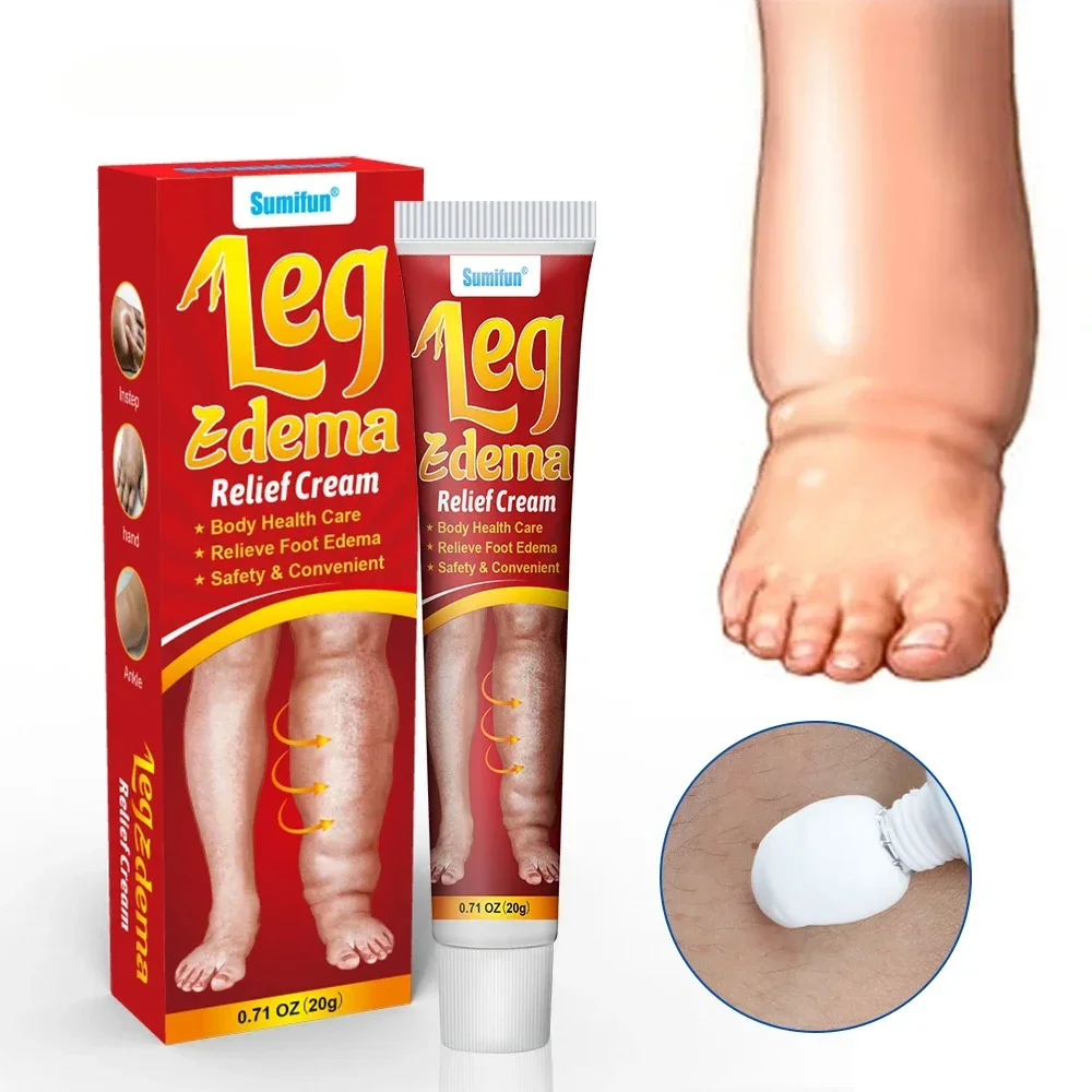 20g Leg Relief Cream for Circulation Relieve Foot Edema Massage Cream for Swollen Legs and Ankles Body Health Care