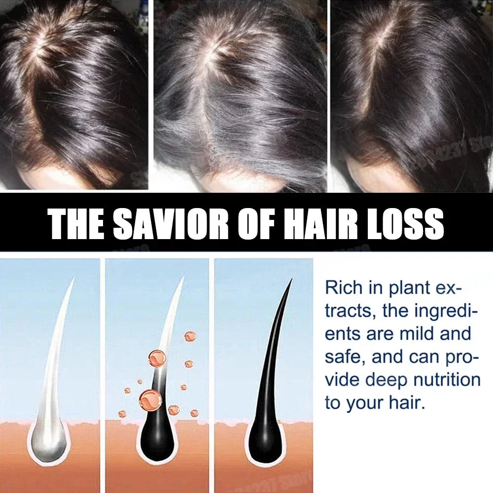 نمو الشعر للرجال والنساء، منتجات سريعة النمو، الزيوت الأساسية، الزنجبيل المضادة لتساقط الشعر، فروة الرأس، العناية بالشعر