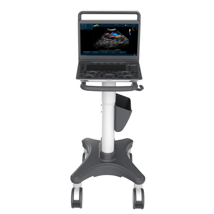 sonoscape e1 exp expert machine 4d ultrasound