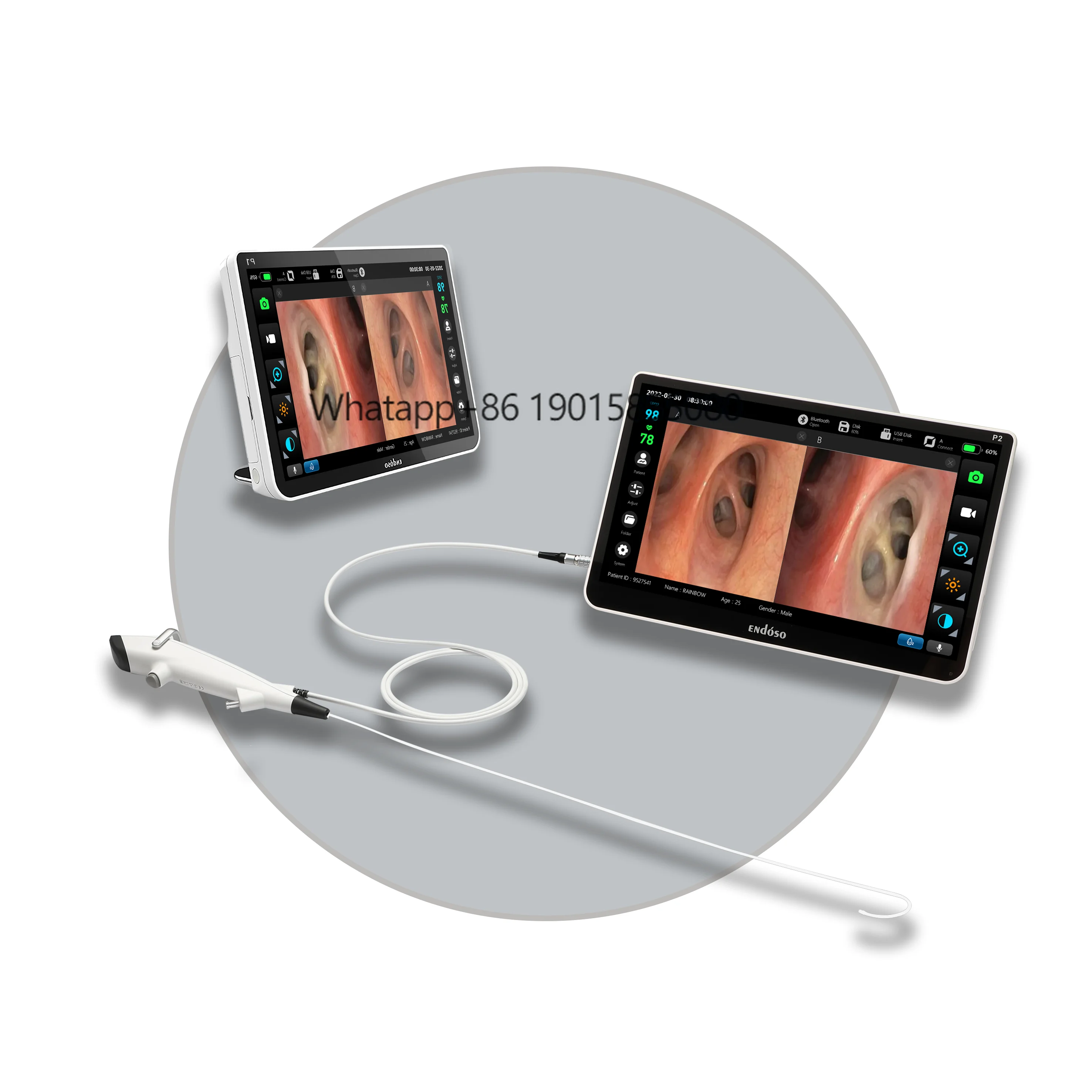 

Endoso Hot Sale 12.1" FHD Light Source Flexible Portable Touch Screen Intelligent Image Processing System for Endoscopes