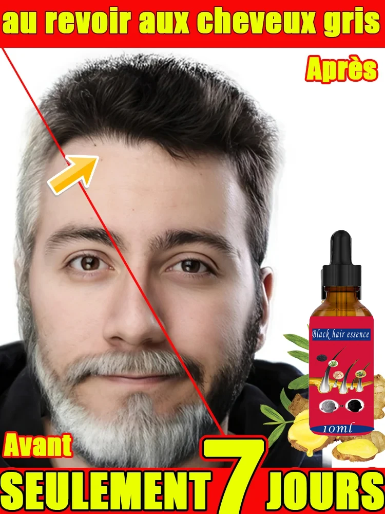 Les Jours Qui Changent Vos Cheveux Gris Découvrez le Sérum Naturel à 7 Jours pour une Repousse Sombre et Saine