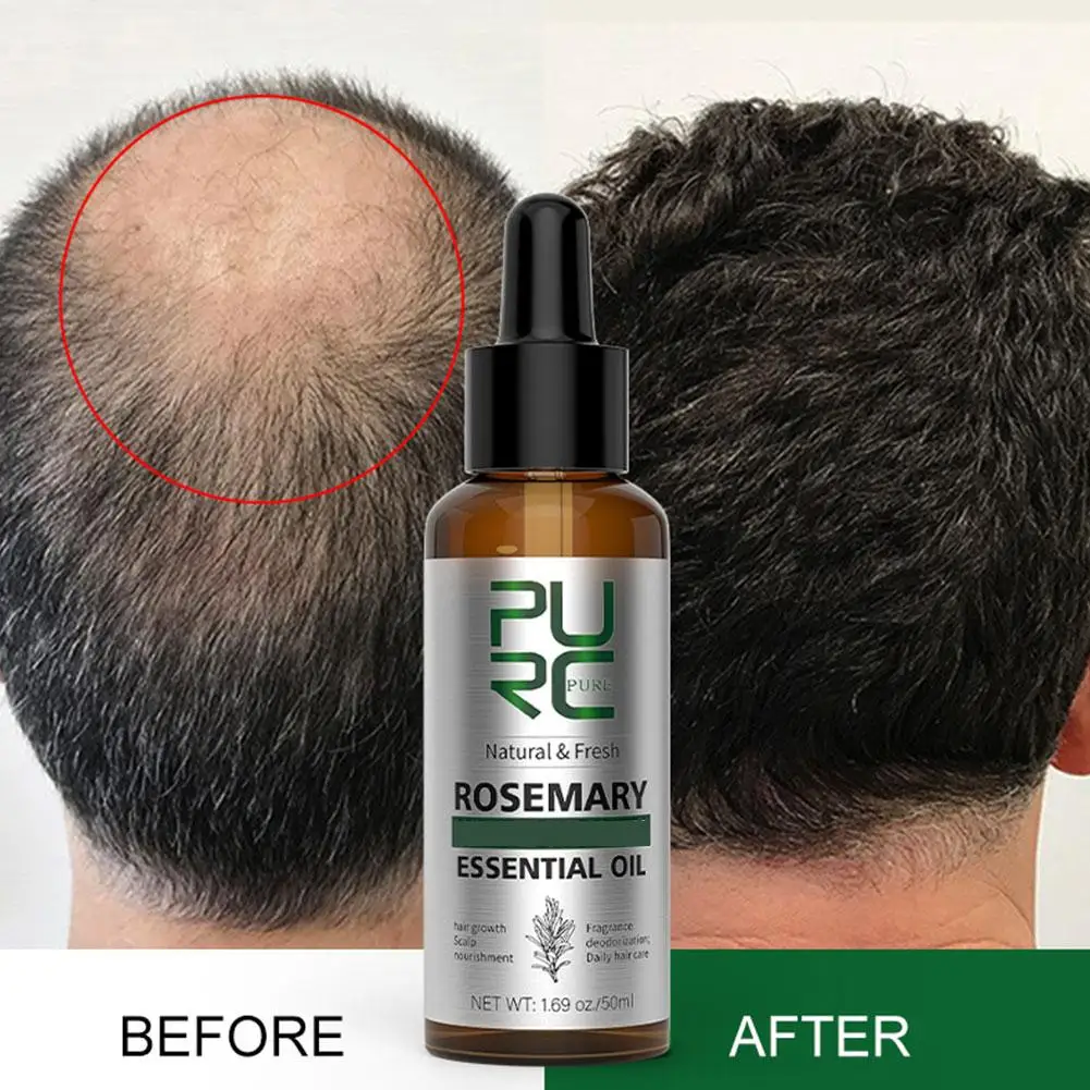 Aceite de Romero para hombres y mujeres, productos de crecimiento rápido, aceites esenciales de jengibre, tratamiento anticaída del cabello, cuero cabelludo, cuidado del cabello M0O5