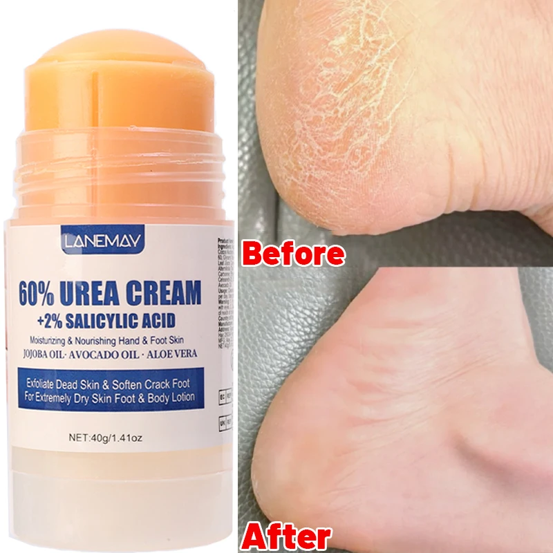 Anti-Drying Crack Foot Cream Stick Heel Cracked Repair Removal Dead Skin Moisturizing Hand Feet Care Nourish Rough Skin Cream