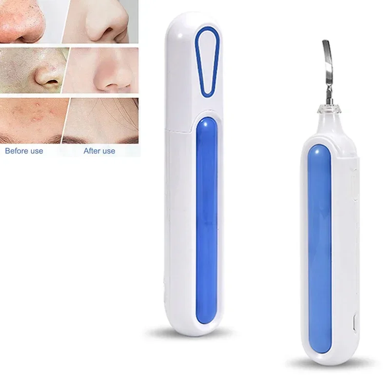 Nova limpeza dos poros rosto purificador purificador da pele facial ultra sônico peeling vibrador kit de cuidados com a pele encolher poros ultra sonic mais limpo