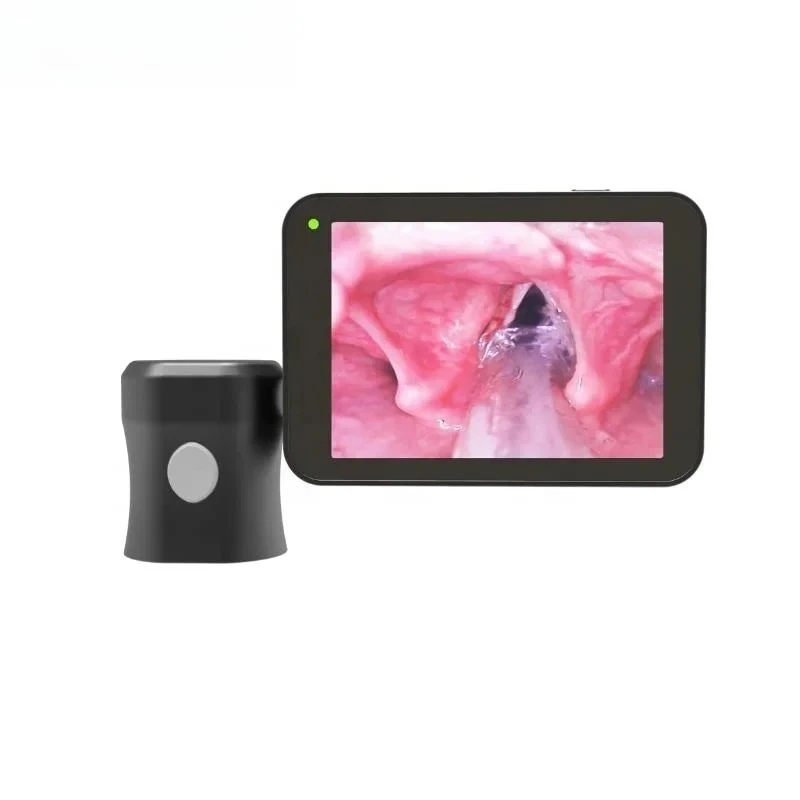 Medical Grade Reusable 3 Inch LCD Screen Player, Left Side Video Laryngoscope Replacement Accessory for Hospital Clinical Use