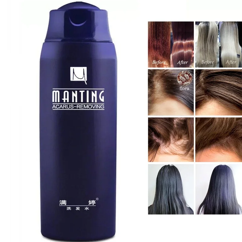 ManTing Professional Shampoo Divide Mite Anti-Itching Anti Dandruff Suitable No Silicone Oil Oil Control for All Hair Types