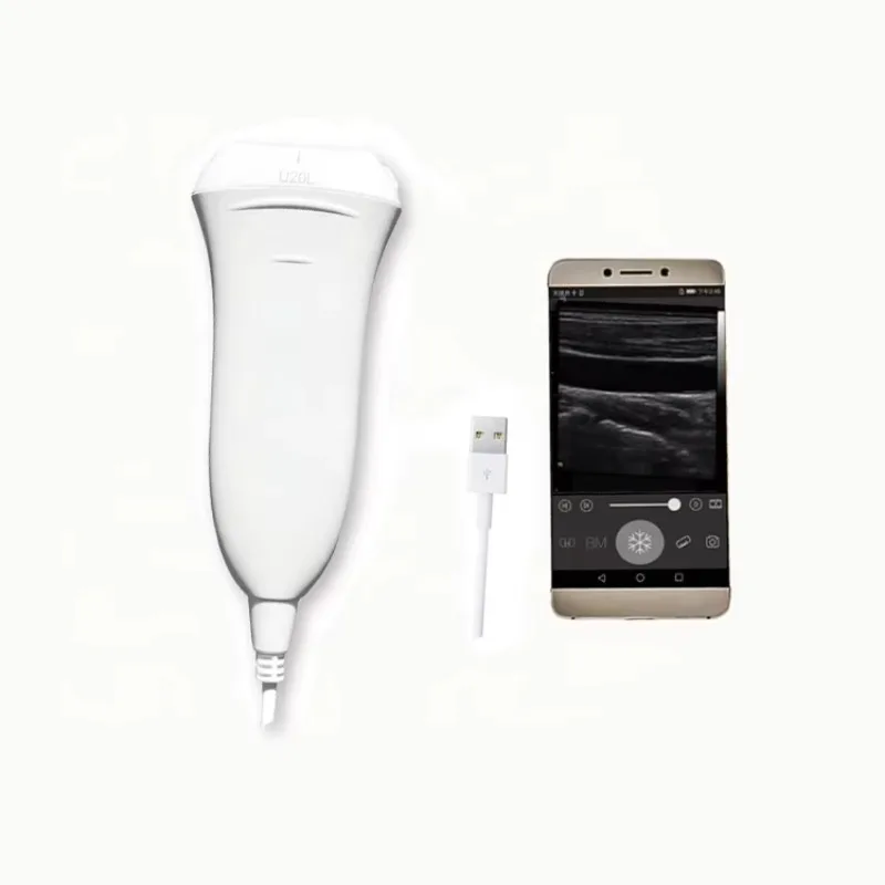Upgrade Handheld Pocket USB Type C Linear Ultrasound Scanner Probe with Software Veterinary Monitoring Device
