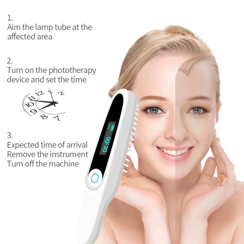 B98A-자외선 UV 미용 기기 UVB 램프는 피부 관리에 사용되어 피부를 보습하고 탄력 있게 만듭니다. EU 플러그