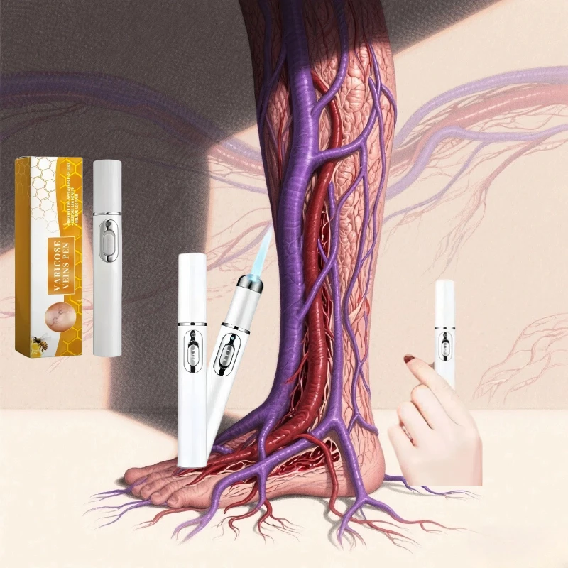 

Восстановите здоровье ног в течение 7 дней и остановите варикозное расширение вен.