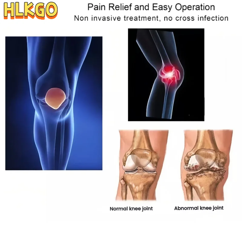 

Red Light Therapy Device Adjustable Intensity Cold Laser for Personalized Arthritis Treatment & Wound Care