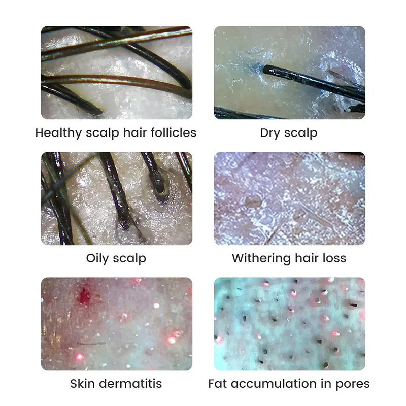 กล้องจุลทรรศน์ดิจิตอลไร้สาย WiFi อิเล็กตรอนเดอร์มาทอสโคป ตรวจหนังศีรษะ รูขุมขน ขยายภาพ วิเคราะห์ผิวหน้า เครื่องมือสำหรับมืออาชีพ