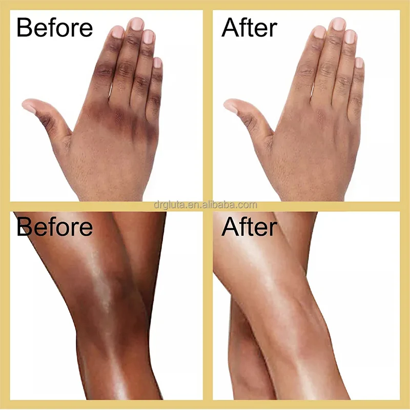 Gluta Master Removing stains Body Lotion Whitening Brightening Skin Knuckles Knees Elbows Anti-Aging Smoothing Skincare Product