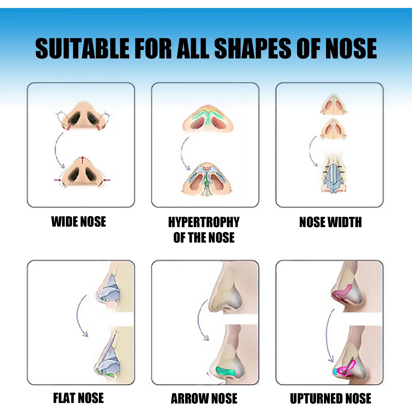 Nose Lifting Essential Oil Lift Up Heighten Rhinoplasty Care Beauty Nose Beautiful Shaping Nosal Bone Remodeling Massage Essence