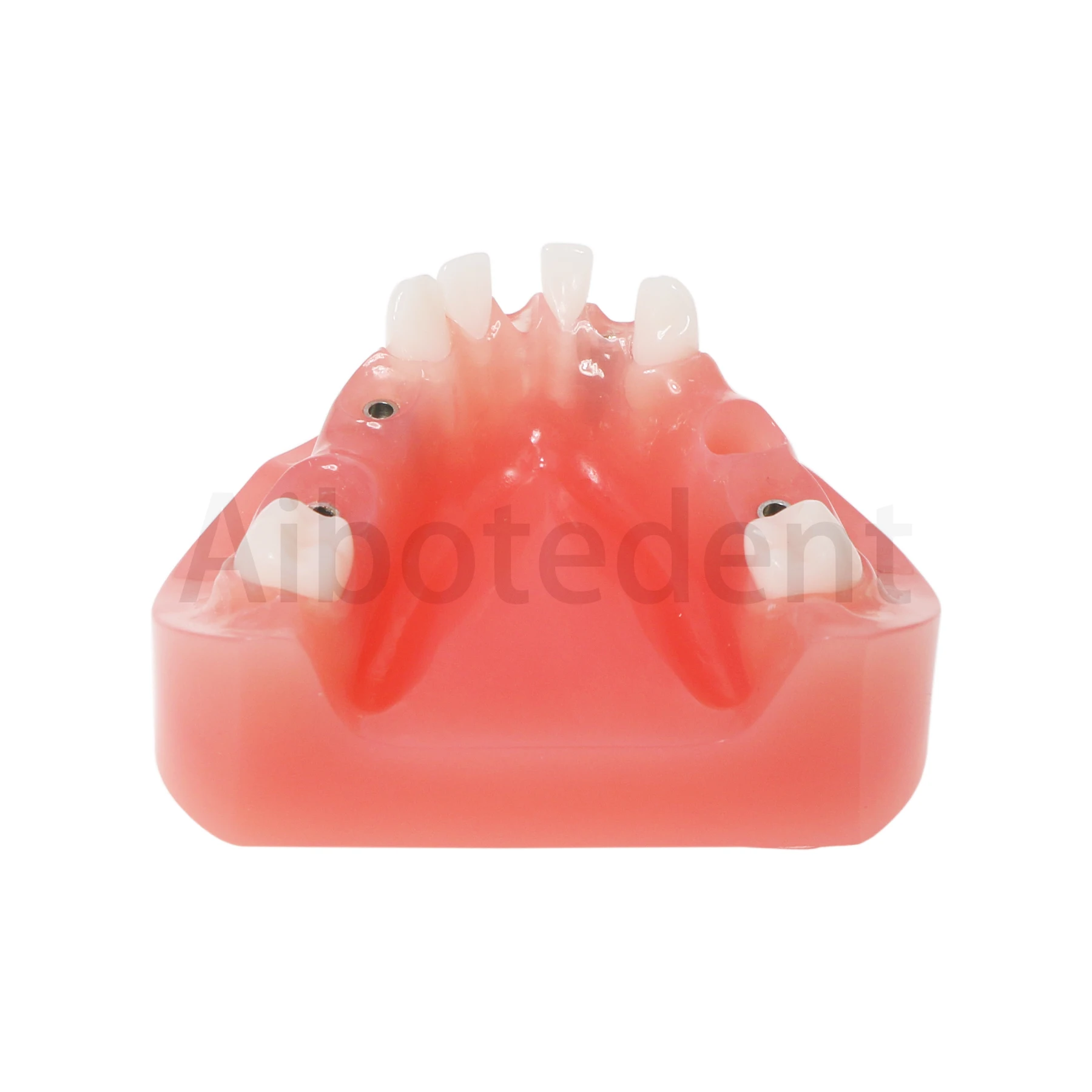 

Dental Implant Typodont M6019 With 4 Screws Low Jaw Type Restpration Model