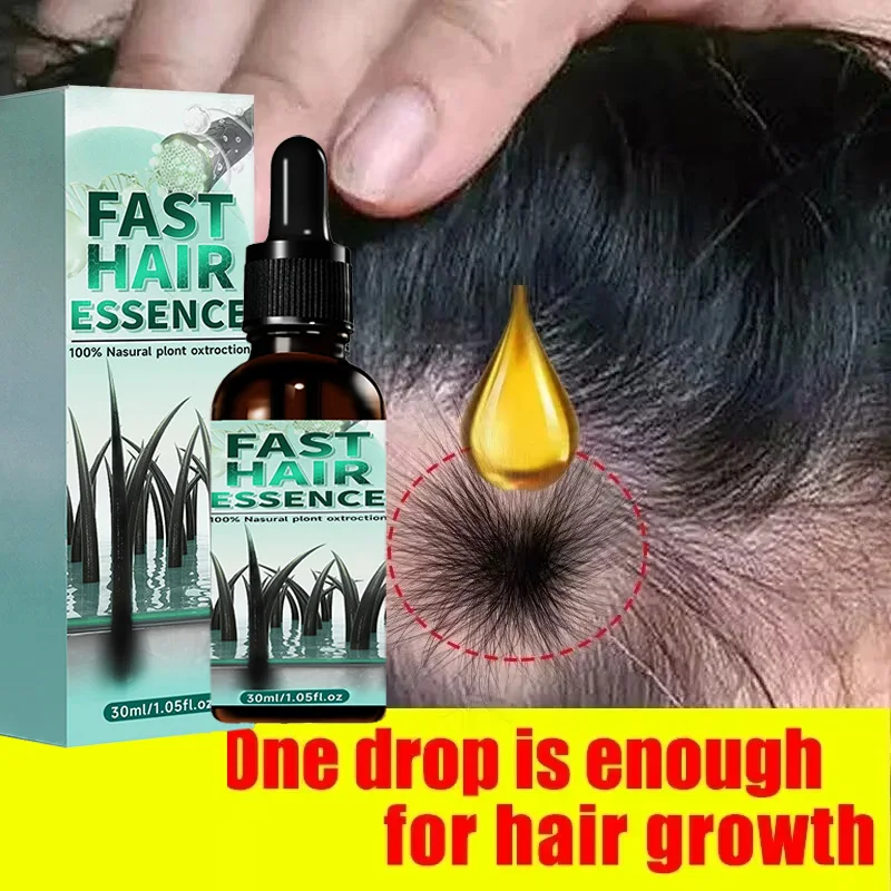 Tratamiento esencial para el crecimiento del cabello, fortalece el cabello, nutre el cuero cabelludo, peso ligero, no graso, mejora la circulación del cuero cabelludo