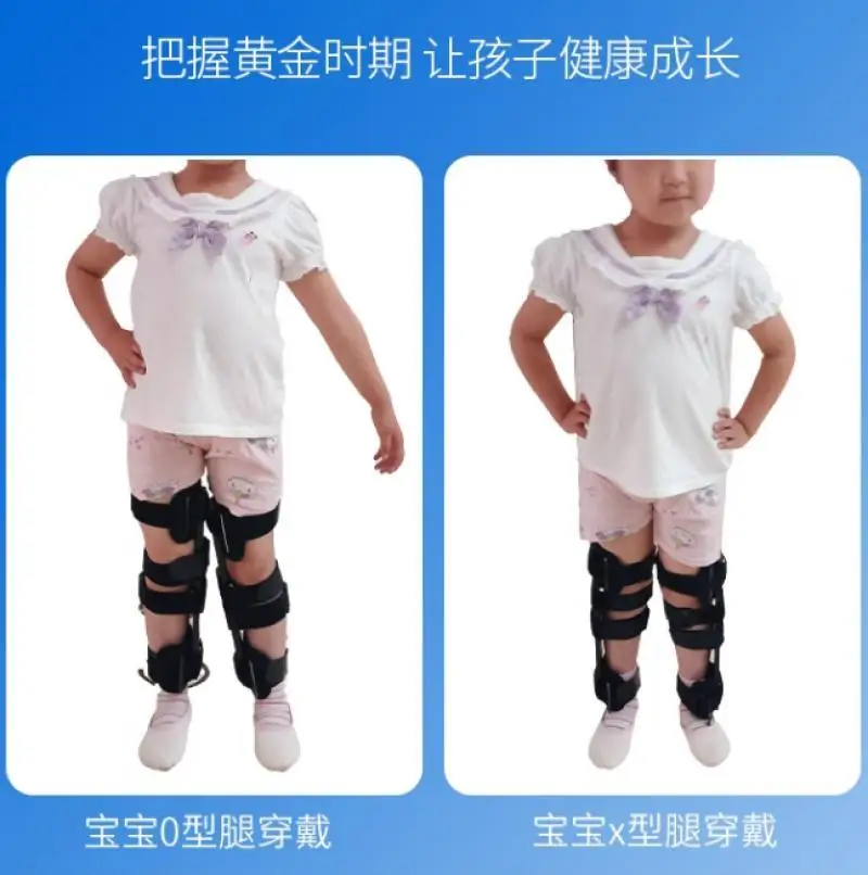 1 Pair Adjustable Children O/X Leg Shape Correction Strap Leg Internal External Rotation Varus Valgus Straightening Tool