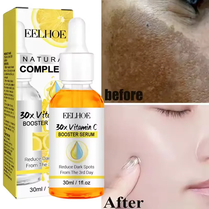 VC Whitening Freckles Face Serum Effective Remove Dark Spots Fade Melanin Improve Dullness Brighten Repairing Skin Care Product