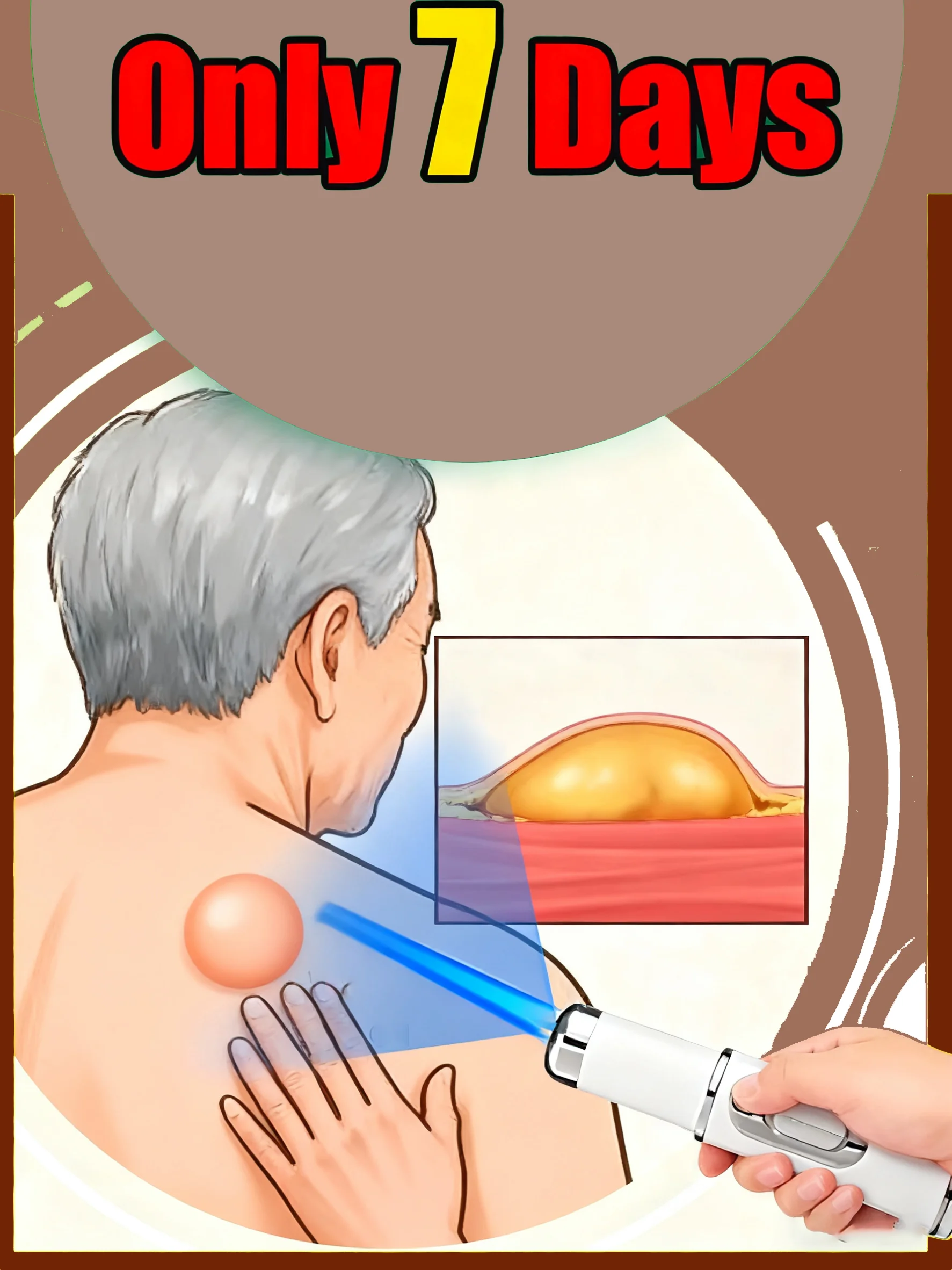 

Skin Health Expert, Manage Your Health, Blue Light Laser Pen, Skin Management Tool