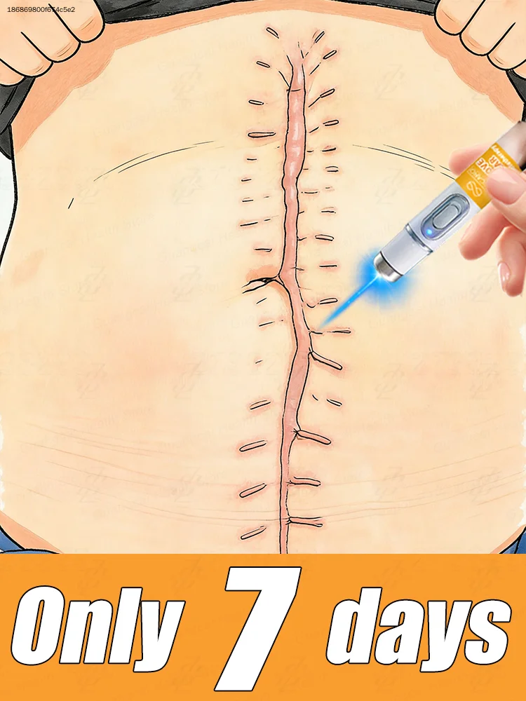 

Хит продаж 2026 года. Средство для удаления шрамов. Универсальный для всех типов кожи.