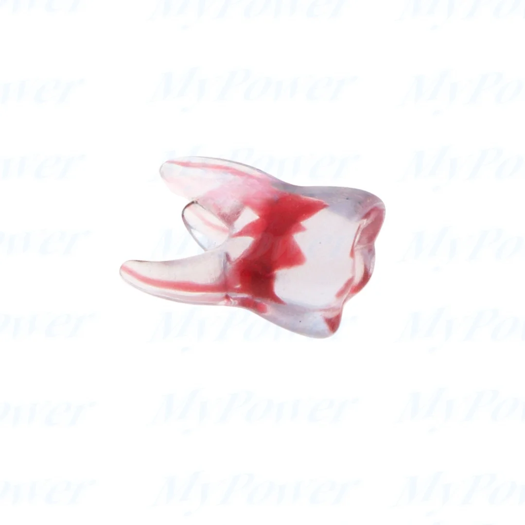 Tandheelkundige Training 3d Rct Endo Tandmodel Oefenmodel Gebogen Wortelhars Tanden