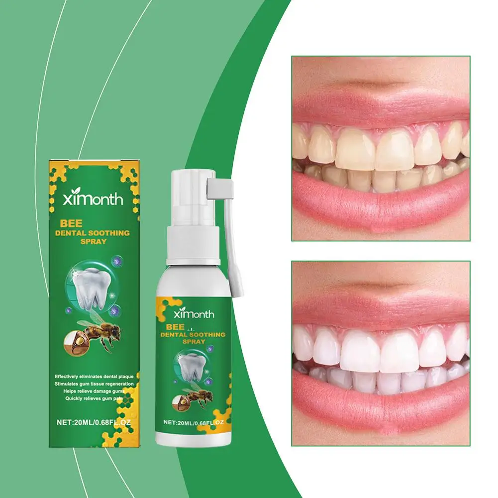 Propolis Oral Health Spray Verse Adem Tand Bescherming Ordor Tanden Vlek 20Ml Mondverlichting Tand Hygiëne Tanden Pers G3d2