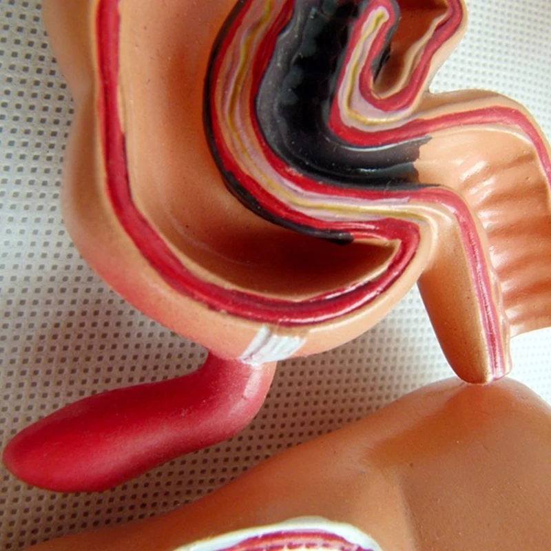 Model dydaktyczny, model anatomii jelit grubych ludzi Model uszkodzenia wizjerów System trawienia człowieka Model edukacyjny łatwy w użyciu