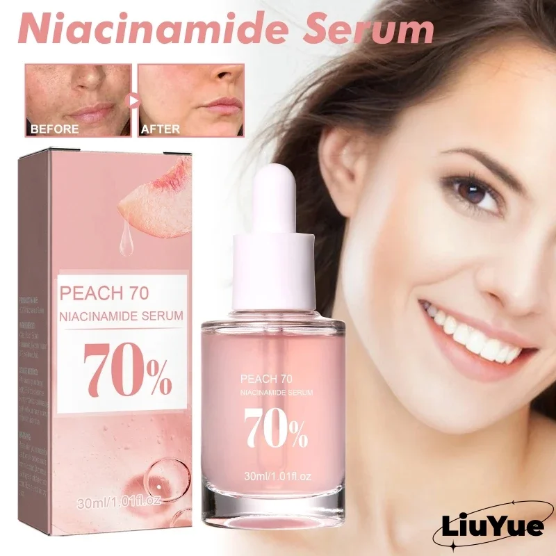 

Niacinamide Serum Remove Dullness Fade Spots Moisturizing Brightening Fade Fine Lines Deep Skin Care Products