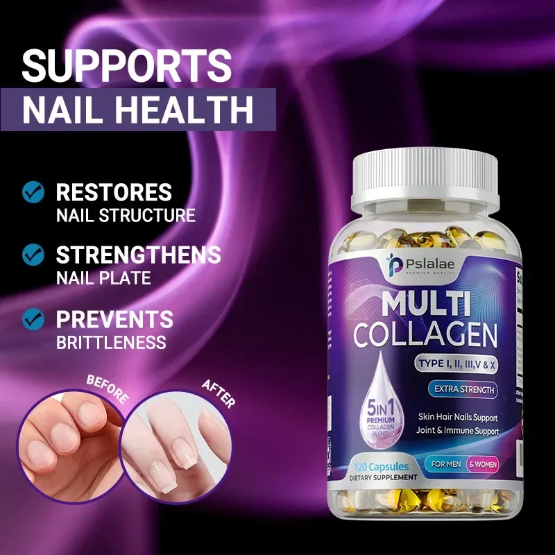 Multiple Collagen Complex - Supports Skin Elasticity, Natural Hair Growth, Improves Nail Health, and Boosts Immunity