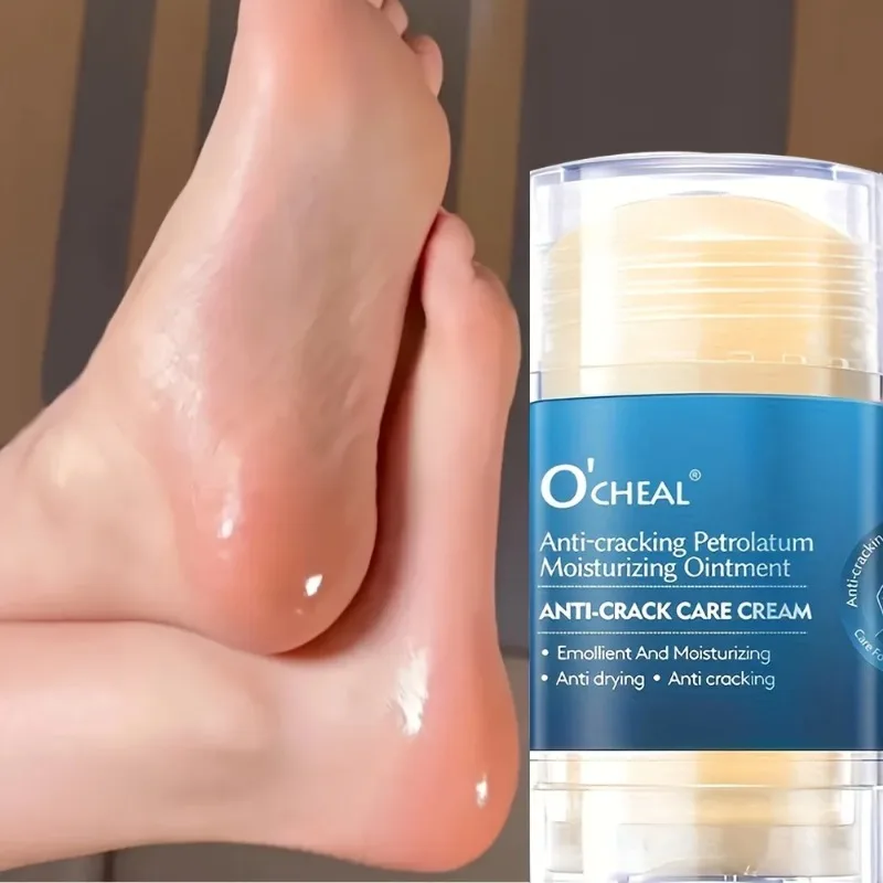 Anti Crack Foot Cream For Dry And Cracked Feet And Heels, Moisturizing Dry Feet And Heels, Preventing Your Feet From Cracking