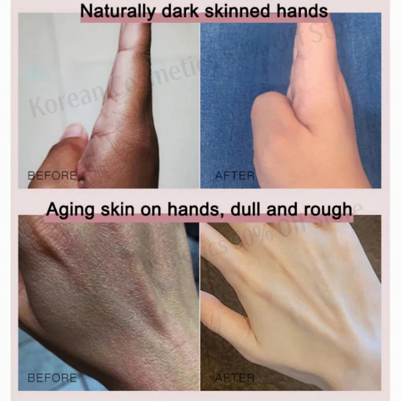 Niacinamide Arbutin Hand Cream Whitening Wrinkle Removal Anti-crack Moisturizing Repair Fade Fine Lines Smooth Skin Hand Care