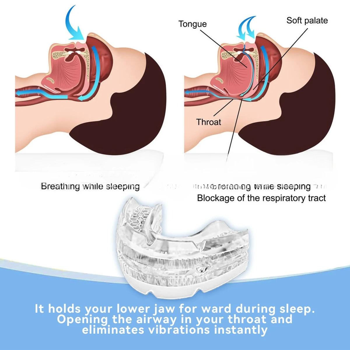 Adjustable braces for anti snoring at night, screw adjustable braces for anti molar support