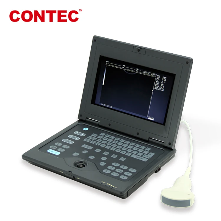 Low price Promotional Laptop Doppler Ultrasound Scanner-CE certified medical ultrasound machine