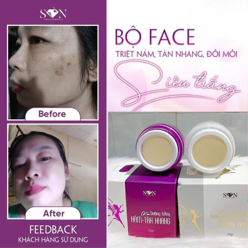 

Kem Face SON Cô Tiên, removing Spots Diluting Melanin,Tặng Kèm Cao Buoi, Combo Ngay Dem Tri Nam Tan,Anti-aging Bright White