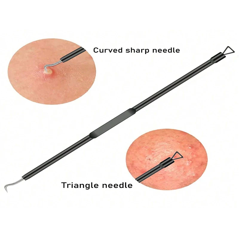 Juego de herramientas para eliminar acné y espinillas, limpiador de poros de acero inoxidable, herramientas para el cuidado de la piel, gancho de aguja de limpieza profunda, eliminador de acné, 4 piezas