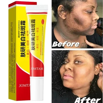 Crema alla Nicotinamide schiarente viso riducente Melasma melanina accumulo schiarente cura dell'essenza della pelle crema viso schiarente