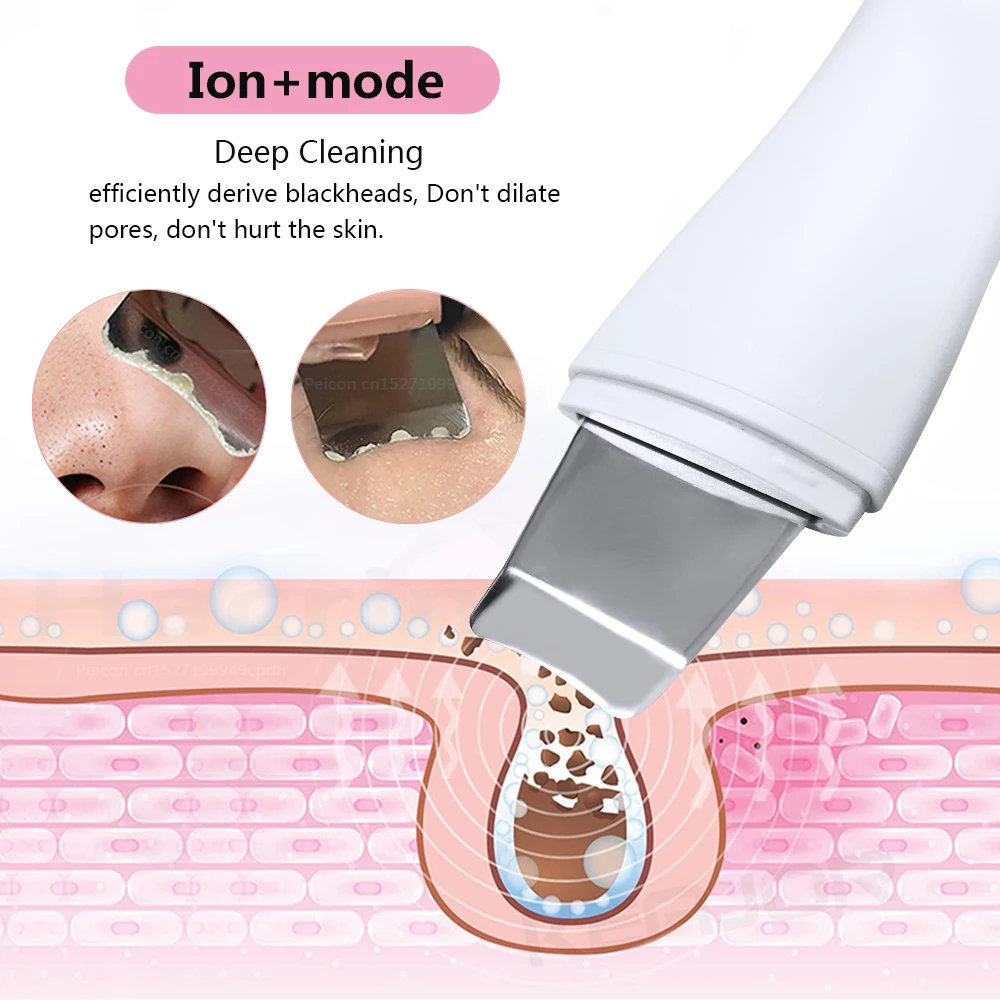 Spatola ad ultrasuoni per il viso Cura della pelle Rimozione di punti neri Punto nero Pulizia del viso Scrubber ad ultrasuoni per la pelle Spatola per il viso profonda Peeling