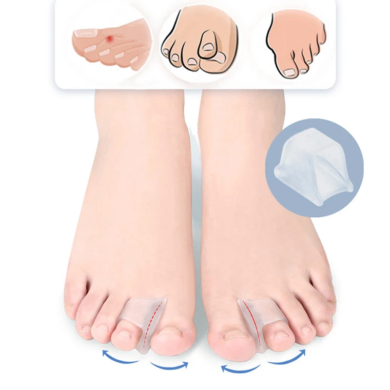 Separador Toe Silicone macio, pé sobreposição corrector, anti-desgaste cuidados almofadas, ferramentas de pedicure, tratar Hallux, Valgus, joanete, 1 par