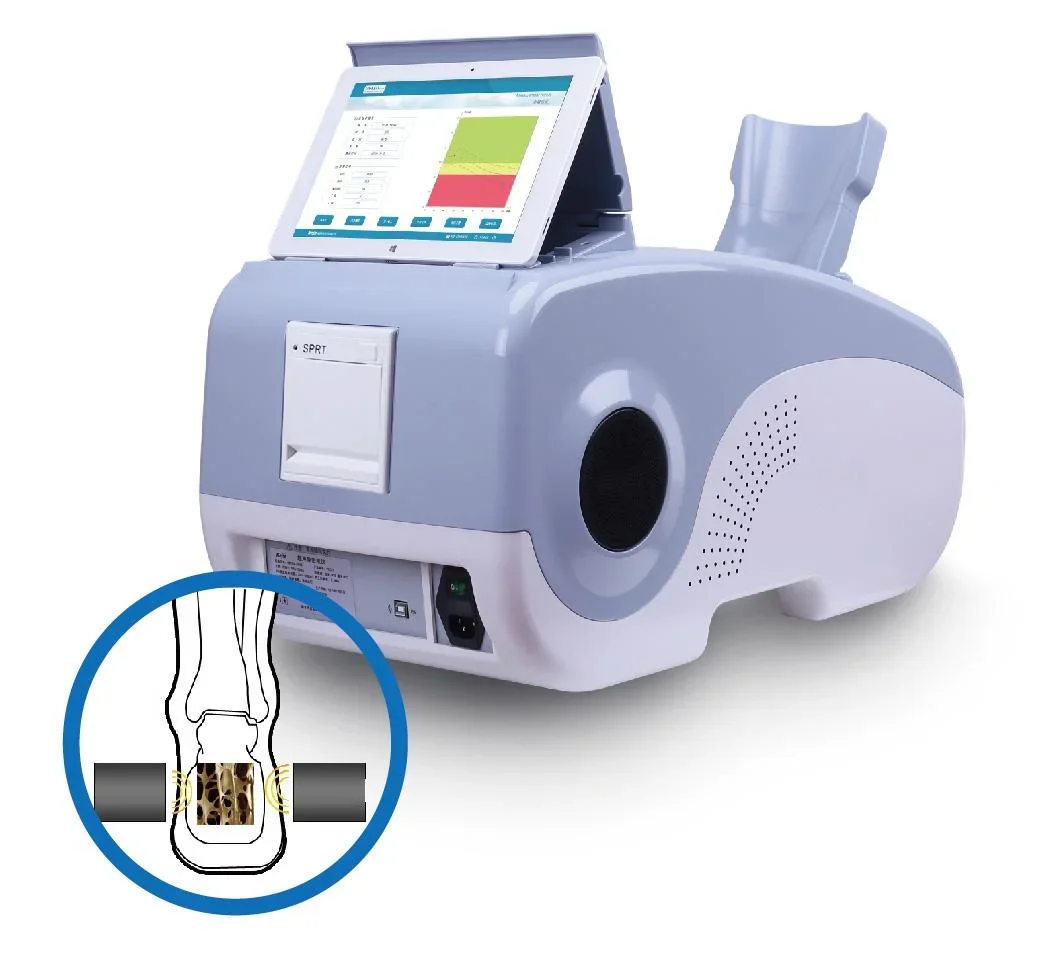 China Medical Bone Density Testing Ultrasound Scan Machine Portable Bone Densitometer Machine