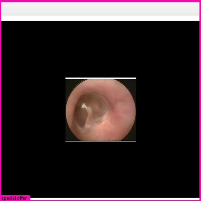 

A65Z Otoscope Ear Endoscope 3.9Mm 4.5 IPS 1080P HD Ear Scope Wax Removal Cleaner Tools With 2500Mah Rechargeable Battery