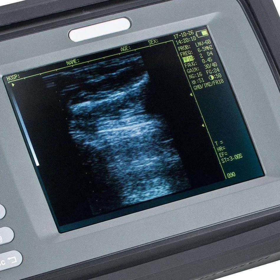 2025 горячая распродажаVS-V504 5,5-дюймовый экран выпуклый зонд ректальный зонд для фермерских животных ветеринарный ультразвуковой аппарат 2025 горячая распродажаVS-V504 5,5-дюймовый экран выпуклый зонд ректальный зонд для фермерских животных ветеринарный ультразвуковой аппарат