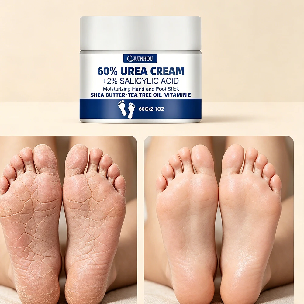 JUINHOU 60% Urea Fußcreme für rissige Fersen, trockene Haut, intensive Feuchtigkeitspflege, Hornhautentferner, glatte Haut, tägliche Fußpflege – Detail 10