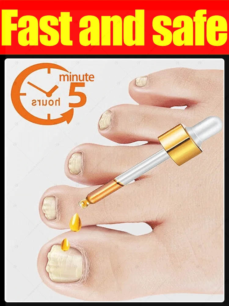 

gray manicure painless rehabilitate，A Week of Farewells