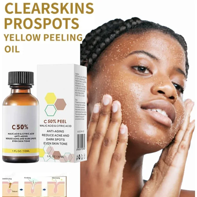 

Yellow Bleaching Peeling Oil Dark Skin Remove Arm Knee Legs Melanin Body Brighten Scrub Exfoliating Dead Skin Care Whiten Serum