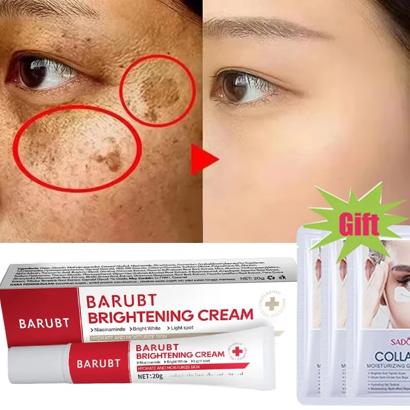 

Powerful Spot-removing Whiten Cream Brighten Skin Fast Eliminates Melanin Pigmentation Melasma Dark Spots Moisturize Beauty Gel