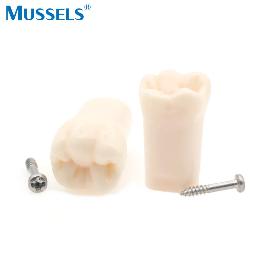 10PCS Dental Zähne Modell Typodont Schraube-in Ersatz Zahn Fit NISSIN Abnehmbare Techniker Praxis Ausbildung Studyting Zahnarzt