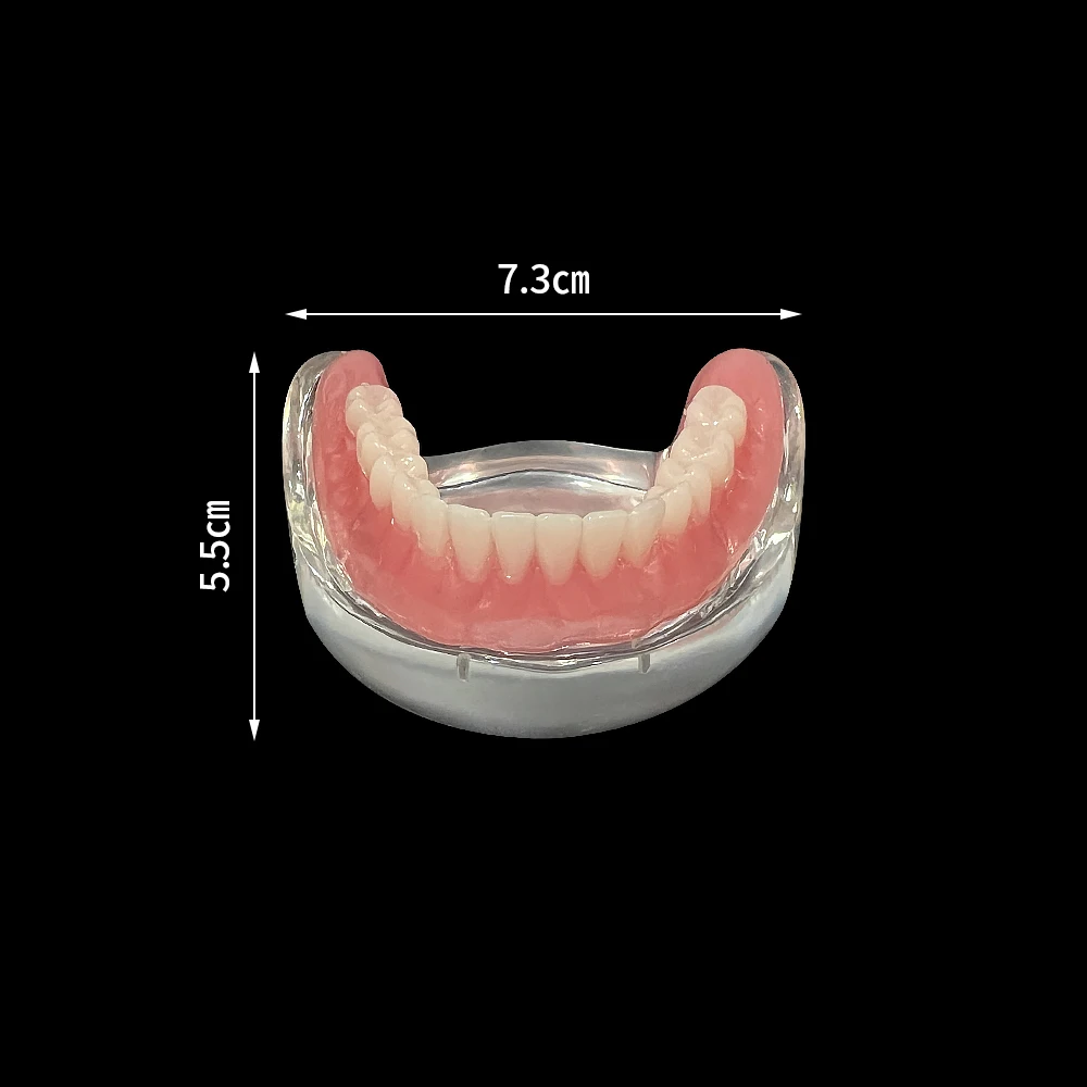 Dentystyczny Model wyjmowanego implantu do komunikacji dentystycznej z dolnym Model zębów dolnym odbudową